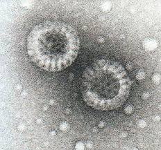 Rotaviruses are the most common cause of diarrhoeal disease among infants and young children. Rotavirus Simple English Wikipedia The Free Encyclopedia