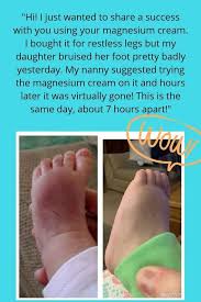Organic Magnesium Lotion Sore Muscles Growing Pains Rls Etsy Magnesium Lotion Vicks Vaporub Vicks Vaporub Uses