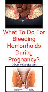 How Long Do Hemorrhoids Last After Giving Birth Bleeding Hemorrhoids Cure For Hemorrhoids Hemorrhoids Treatment