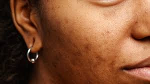 neem pure soap in patiala