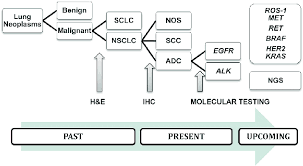 The earlier lung cancer is diagnosed, the more likely tumors can be removed successfully via surgery (including sleeve resection, segmentectomy, and lobectomy), chemotherapy, or radiation. Historical Lung Cancer Diagnosis Pathway Adapted With Permission From Download Scientific Diagram