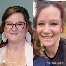 Gastric sleeve results