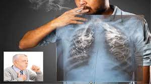 Tobacco smoke contains more than 60 different toxic. Signs Of Lung Cancer You Should Never Ignore The Daily Guardian