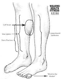 How To Treat Lower Leg Pain At Home Walking For Health And Fitness