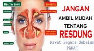 Cara mengatasi hidung tersumbat yang satu ini mengharuskan kamu untuk menyemprotkan cairan ke dalam hidung yang terbuat dari larutan garam. 8 Petua Mudah Hilangkan Resdung Dan Hidung Tersumbat Yang Cukup Berkesan