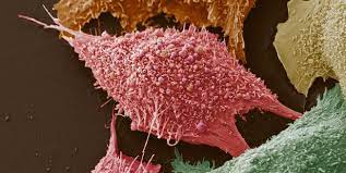 It looks like a small. What Do Cancer Cells Eat Elife Science Digests Elife