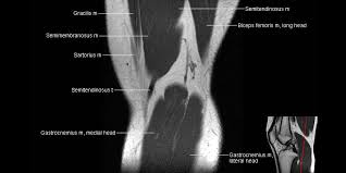 Scroll through the structures to understand the anatomy. Knee