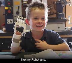 The first diy prosthetic hand, which he made at age 14, won 3rd place at the colorado state science fair. Diy Free Sourced Prosthetics Prosthetic Hand