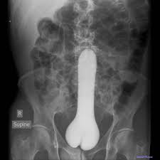 xray hentai of penis inside vagina - Hentai 44