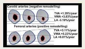 Class diagram is not only used for visualizing, describing, and documenting different aspects of a system but also for constructing executable code of the software application. Schematic Representation Of Remodelling Remodelling At The Level Of Download Scientific Diagram