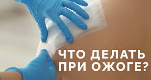 Chto Delat Pri Razlichnyh Ozhogah Sovety Pri Ozhoge Kipyatkom Maslom Parom