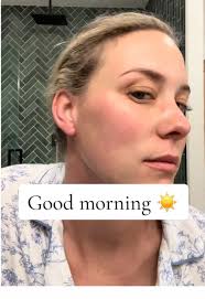 Witch Hazel Shea Butter Beef Tallow