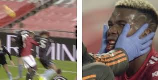 Слушайте и скачивайте mings бесплатно на хотплеере в mp3. Video Tyrone Mings Reckless Elbow Leaves Paul Pogba Blooded