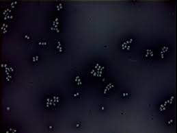 It is a facultative anaerobe, thus capable of using oxygen for aerobic respiration under aerobic conditions, or an alternative terminal electron acceptor for anaerobic. Negative Stain Results