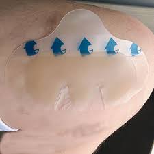 4.انواع پانسمان هیدروکلوئید 