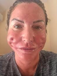 Doctors reveal that eating tomato🍅 causes... See more