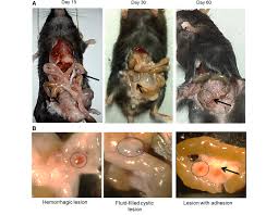 Risk factors age, uterine abnormalities, history of pelvic infection and family history. Morphology Of The Ectopic Endometrial Tissue In A Surgically Induced Download Scientific Diagram