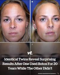 They're not identical anymore 😮