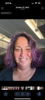 Gray hair in 30-39 year olds?