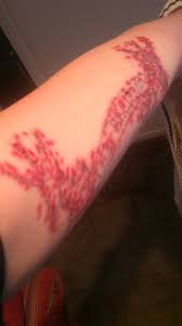 The lasers heat the ink particles to thousands of degrees, but it. Tattoo Be What You Dream