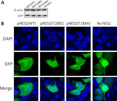 Lei moldovenești per 1 euro22 feb.1 mar.8 mar.15 mar.20,620,82121,221,4. Phosphorylation And Dephosphorylation Of Threonine 188 In Nucleoprotein Is Crucial For The Replication Of Influenza A Virus Sciencedirect