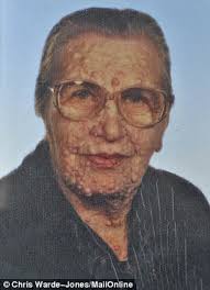 I felt as though my heart was leaving my body': Terribly disfigured man who  was held by the Pope relives the moment that moved the world