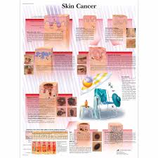 Skin Cancer Glossy Chart