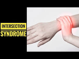Image result for Intersection Syndrome