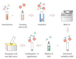 Image result for Direct Coombs