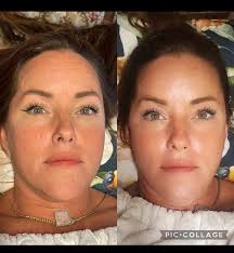 Get amazing results with PCA Skin only available