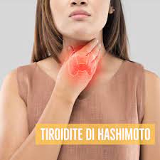 Sono dinanzi ad una tiroide integra che produce una quota normale di t4 che però si converte poco in t3: Cos E La Tiroidite Di Hashimoto E Cosa Mangiare Dott Nicola Savarese
