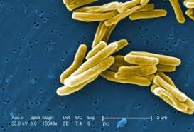 When hiv is identified and treated, outcomes for tb if left untreated, a tuberculosis infection can turn into a deadly disease. Amazing Photo Shows Deadly Tuberculosis Bacteria Up Close Live Science