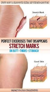 Pin On Natural Health