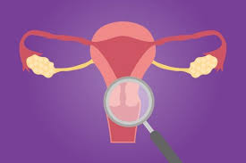 Utero Retrovertido E Fertilidade Entenda Essa Relacao Elas Por Elas Portal Gaz