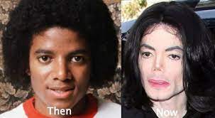 It's more than just breast augmentation and rhinoplasty. Cosmetic Surgery Gone Wrong 53 Celebrity Plastic Surgery Gone Wrong Before And After Worst Plastic Surgery Gone Wrong Celebrity Plastic Surgery Plastic Surgery