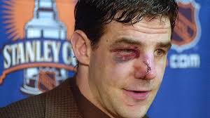 Playoff Battle Scars