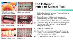 Pin On Complete Guide To Keep Your Teeth White