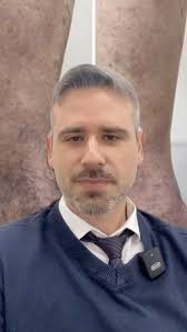 @centromedicorevitalle @revitallevascular