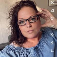 Coated Xolo mix with bald spots due to hairless genes?