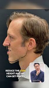 Todd Hanna, MD, DDS, FACS...