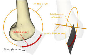 Image result for Patella Tracking Assessment