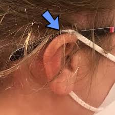 Nov 29, 2017 · the weighted accessories slip onto the tips of your eyeglass earpieces/temples and create a counterbalance that gently lifts glasses off your nose, preventing nose dents, red marks, and keeps your glasses from sliding down your nose. How To Keep Glasses From Falling Off With A Face Mask