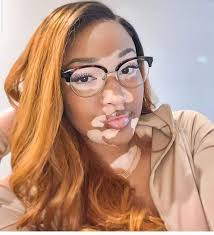 People don't like me because of my skin. Am I still beautiful please?