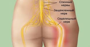 Sedalishnyj Nerv Simptomy I Lechenie V Domashnih Usloviyah Oficialnyj Sajt Gbuz Rodilnyj Dom 2 G Magnitogorsk
