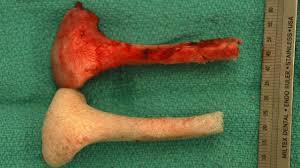 Lab-grown bones restore pig faces