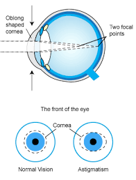 All eye shapes are beautiful, and once you know yours, you'll be able to accentuate the natural shape of your eyes with the right kind of eye makeup. Astigmatism Ezekiel Eyes Contact Lenses Perth