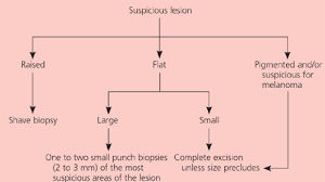 The preferred type of biopsy. Diagnosis And Treatment Of Basal Cell And Squamous Cell Carcinomas American Family Physician