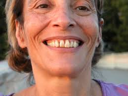 How much is general health affected by oral health?