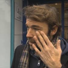 VIDEO Fracture pour Patrick Puydebat à l'entraînement de Splash !