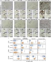 Inflammatory responses in the placenta upon SARS-CoV-2 infection late in  pregnancy: iScience